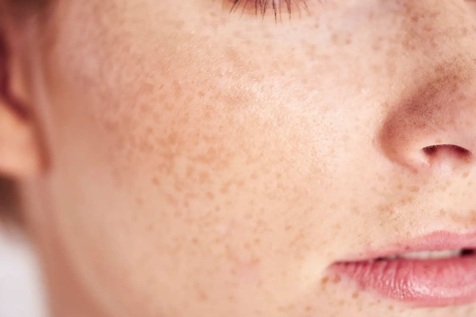 Facial skin with areas of darker pigment
