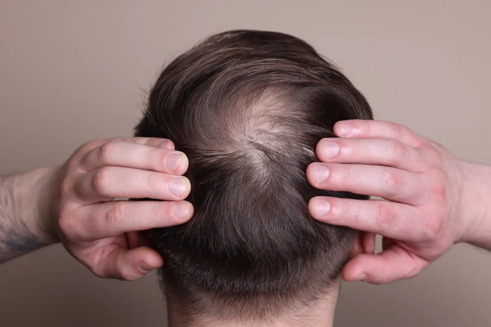 Scalp and hair part showing gradual thinning